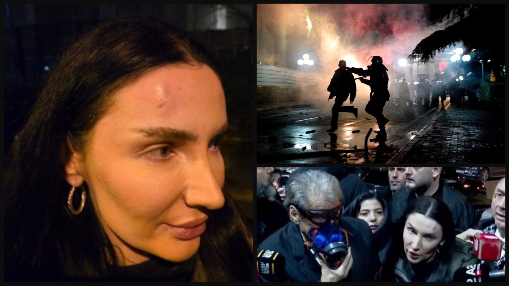 Qëllohet me plumb gome  Senada Mehmeti gjatë protestës