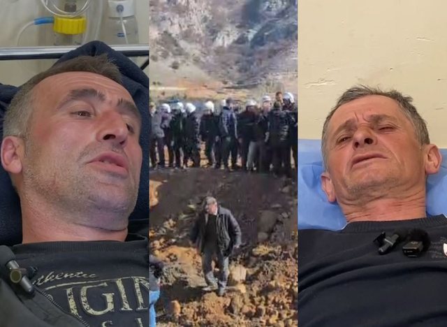 Protesta në Rrjoll, banorët përfundojnë në spital, akuza të rënda ndaj policisë