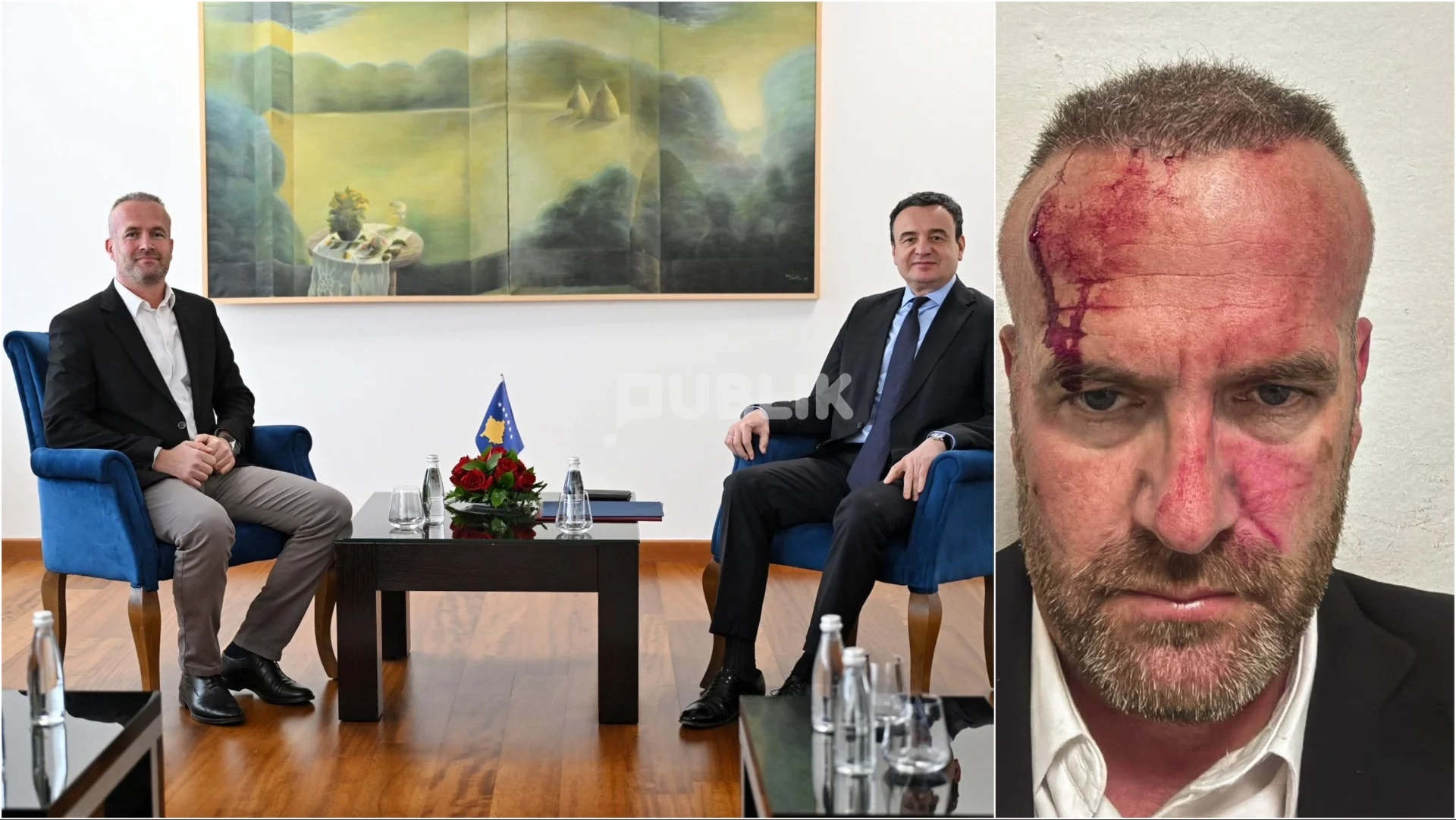 Denoncimi i Korreshit: Po na hanë minjtë në pediatrinë e Lushnjës
