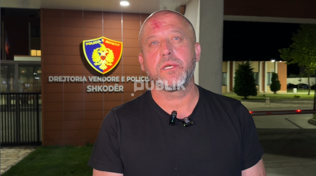 Akuzohet se rrahu gazetarin, arrestohet biznesmeni shkodran