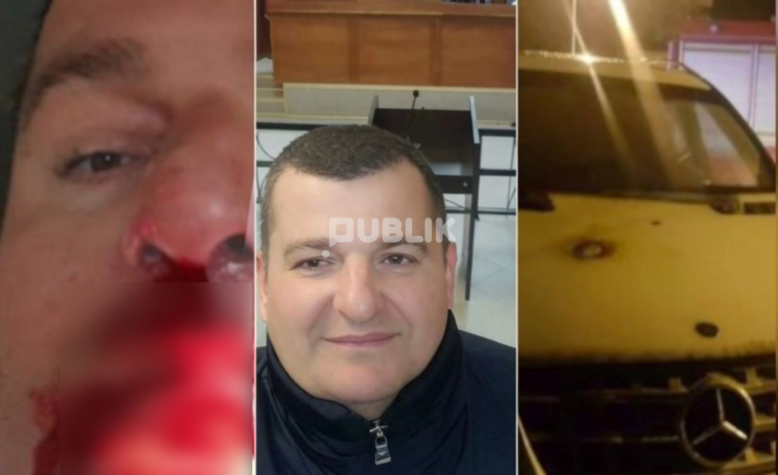 Biznesmeni Eduard Alikaj dhunohet brenda qelisë në Vlorë
