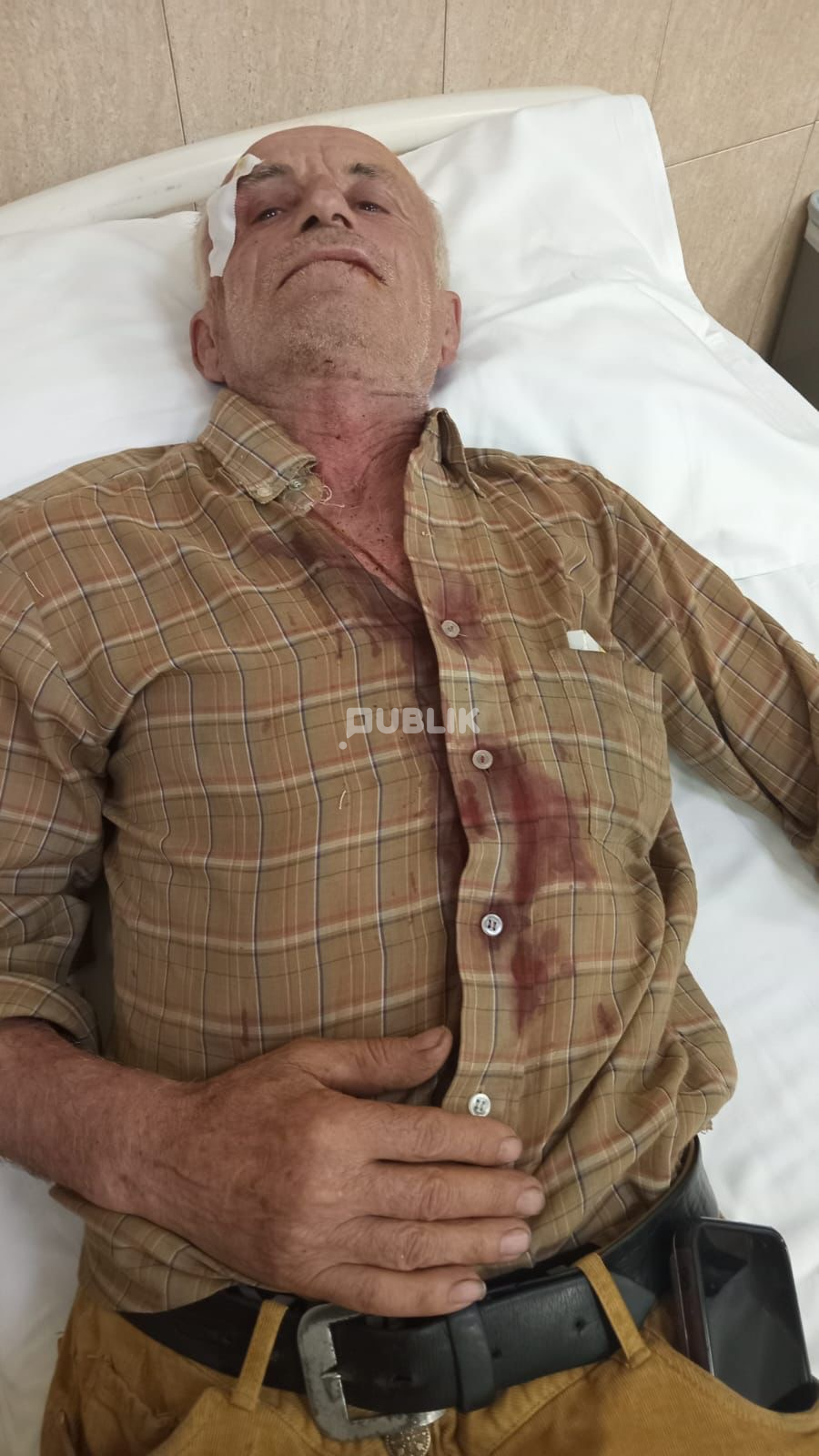 Del fotoja e të moshuarit që u bë për spital nga kunati i Luiz Ejllit