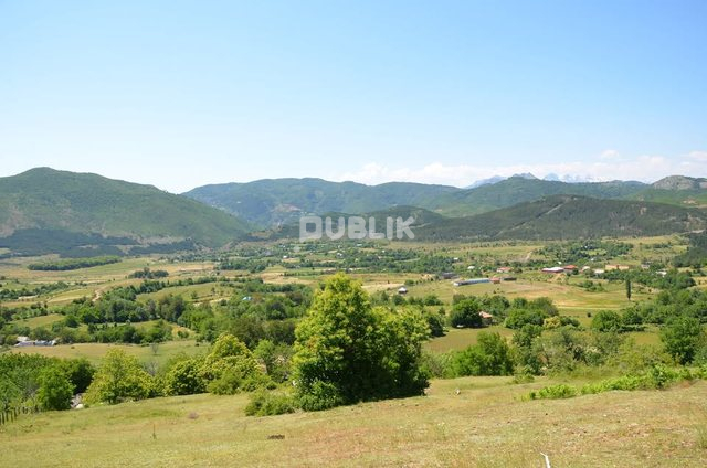 Dhunë brutale në Fushë Arrëz, çifti përfundon me fraktura