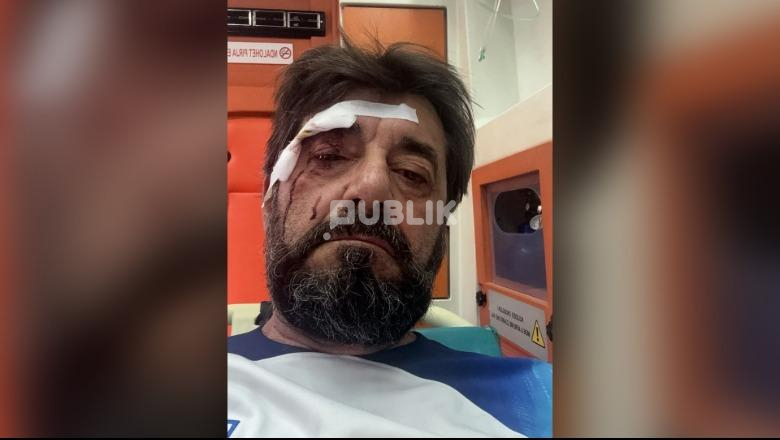 Analisti Ilir Demaliaj dhunohet brutalisht pranë banesës së tij