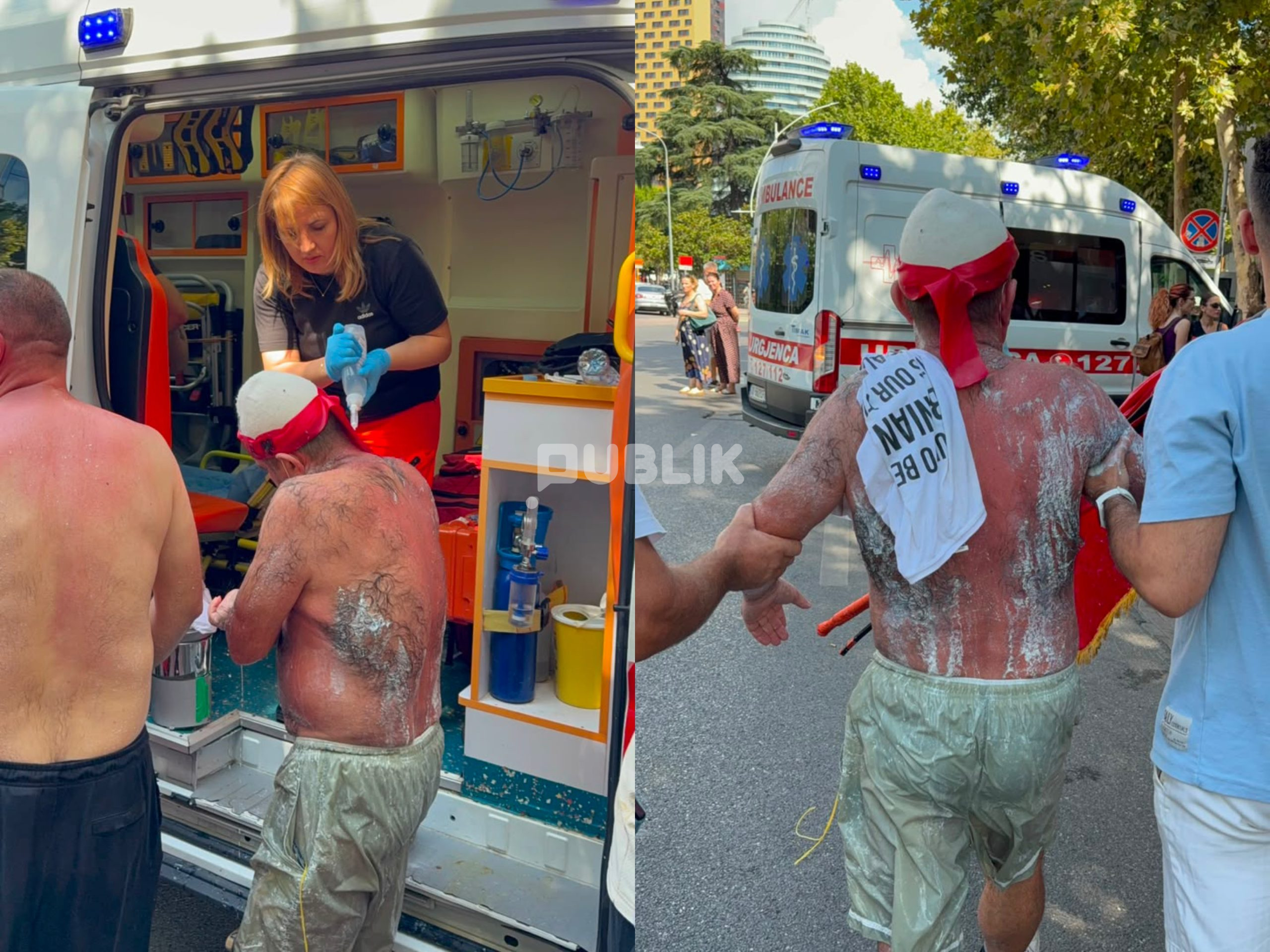 Përdorimi i lëndëve irrituese nga policia në protestë me pasoja