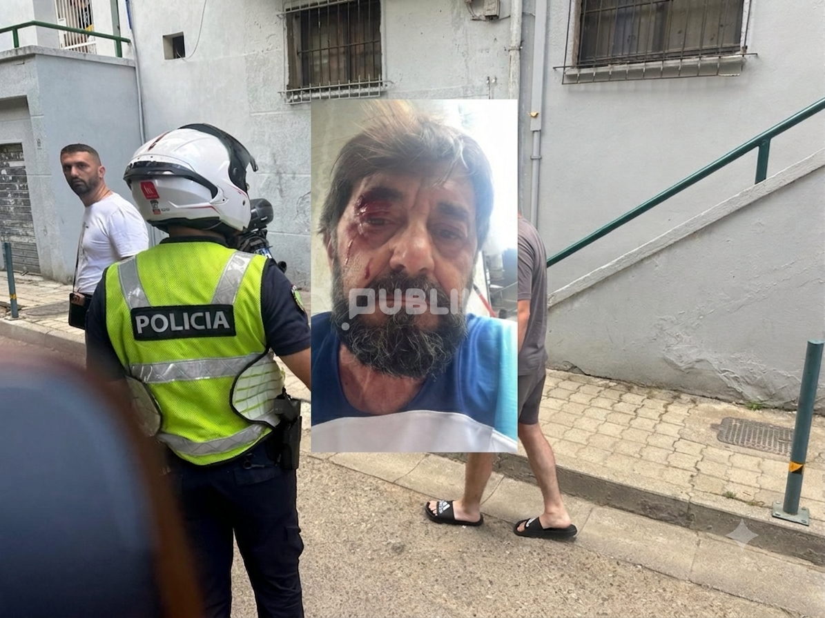 Arrestohet personi që goditi analistin Ilir Demalia