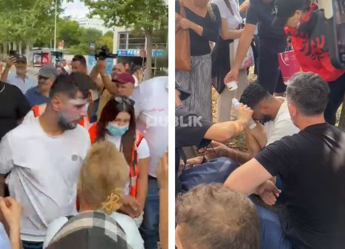 Policia i hodhi spraj në fytyrë, protestuesi përfundon në spital