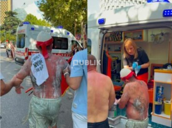 Protestuesit me djegie në lëkurë, probleme në frymëmarrje dhe shikim