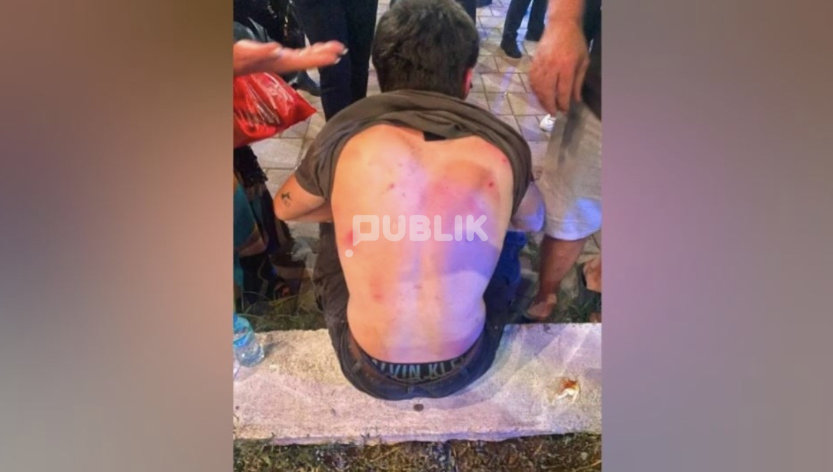 Sherri i turistëve italianë me të miturit në Tiranë, reagon policia