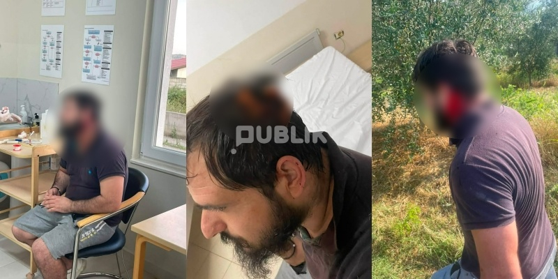 Denoncimi: Po na marrin tokën, fqinjët na dhunuan në sy të policisë