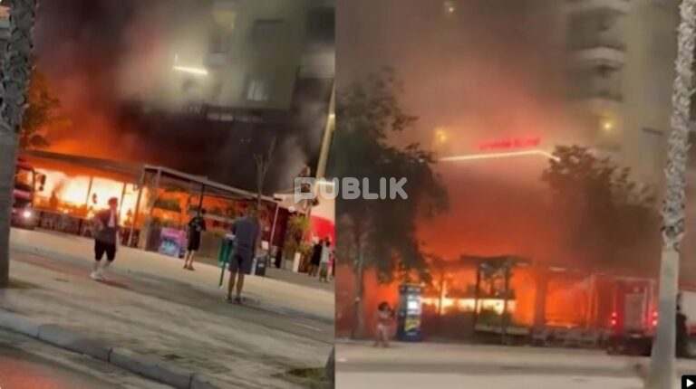 Pësoi djegie nga zjarri te hotel “Brooklyn”, 25-vjeçarja dërgohet për trajtim në Turqi