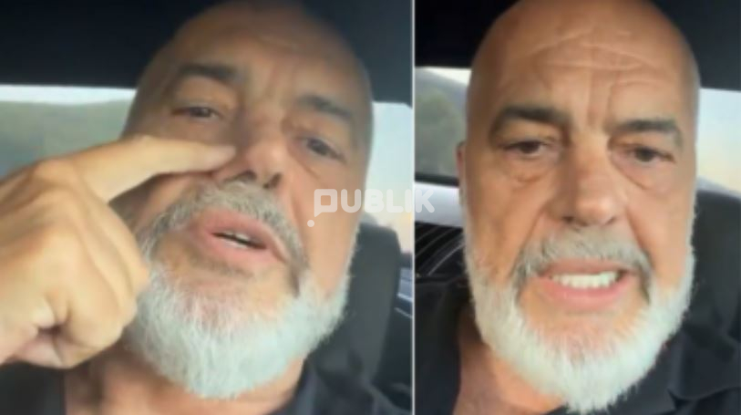 “I gjori” Rama: Devijimin në hundë nuk e kam nga droga se nuk e pi