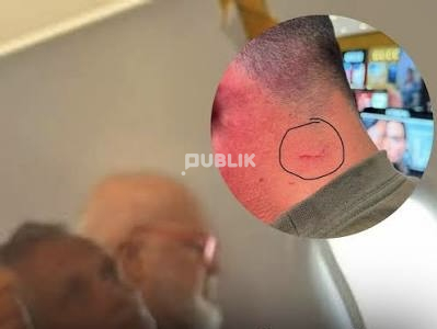 “Të zhduk”, Fabian Peka rrëfen incidentin me Ramën në avion