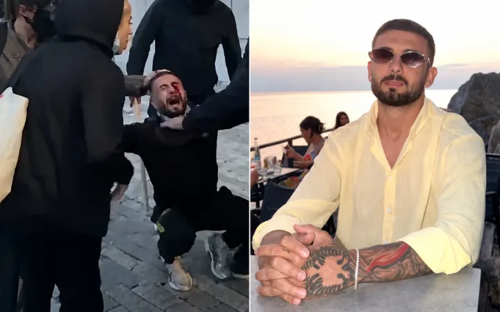 Kush është 28-vjeçari i “Tifozave Kuq e Zi” që u plagos në sy me plumb gome