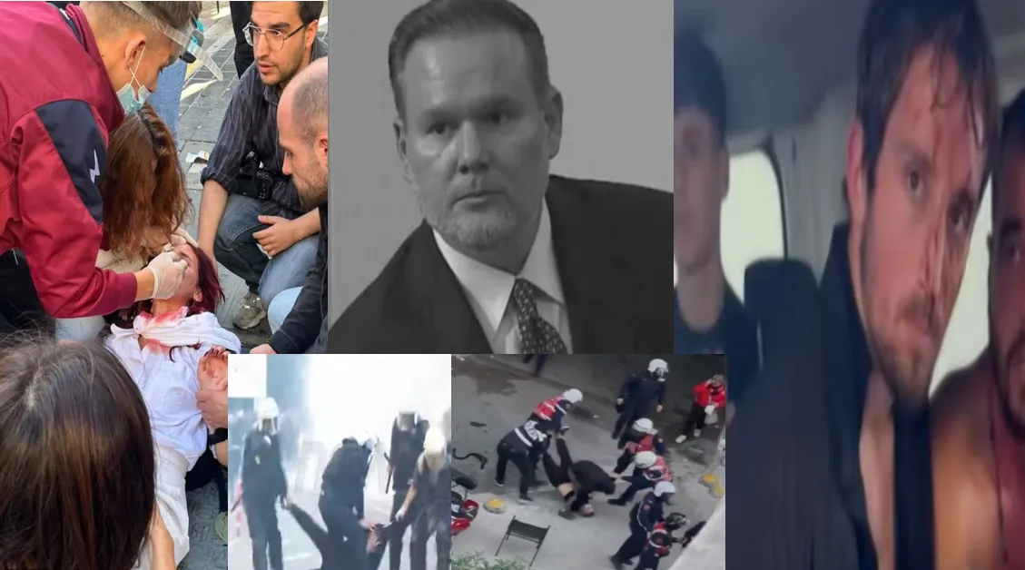 Ervin Demon ‘nuk e zë dot gjumi’: Do hetojmë veprimet e policisë