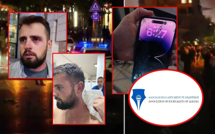 Policia dhunon gazetarin: Më goditën me shkelma dhe grushte