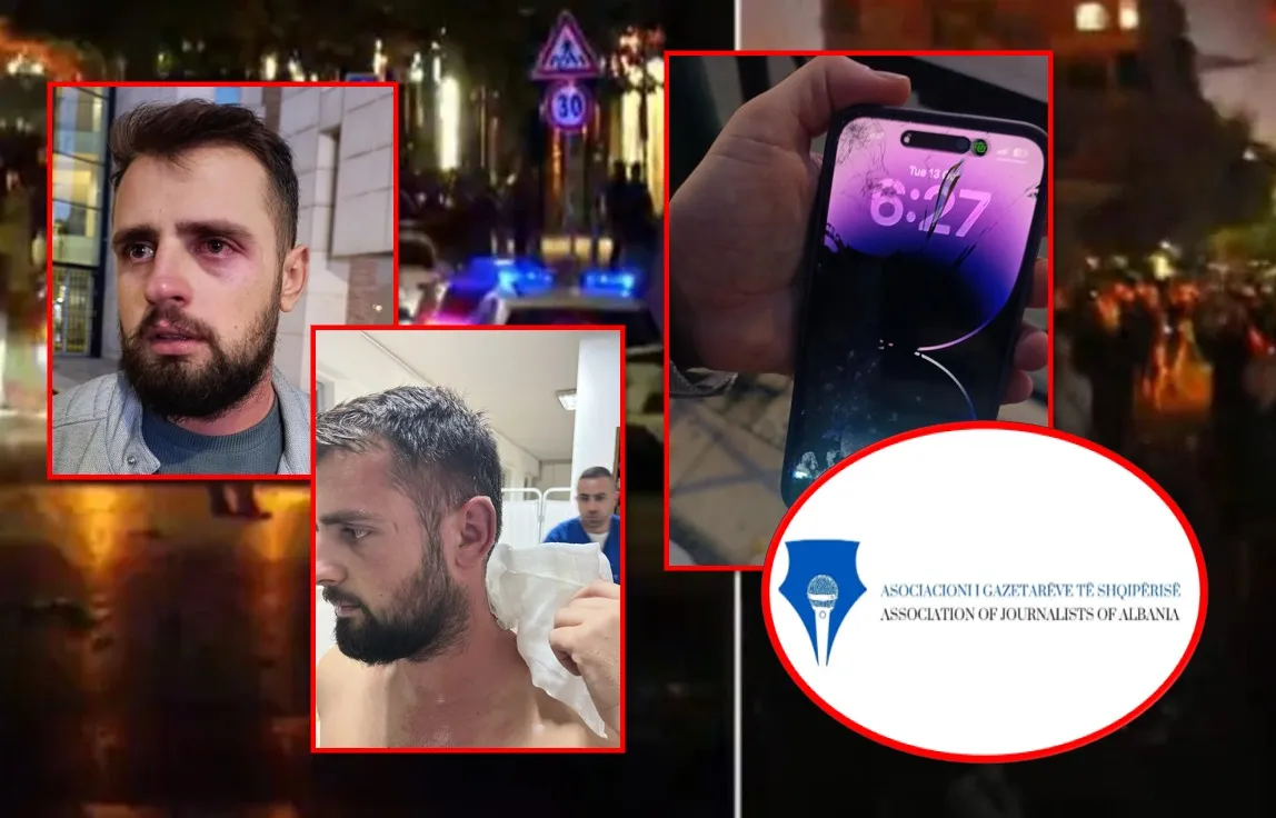 Policia dhunon gazetarin: Më goditën me shkelma dhe grushte