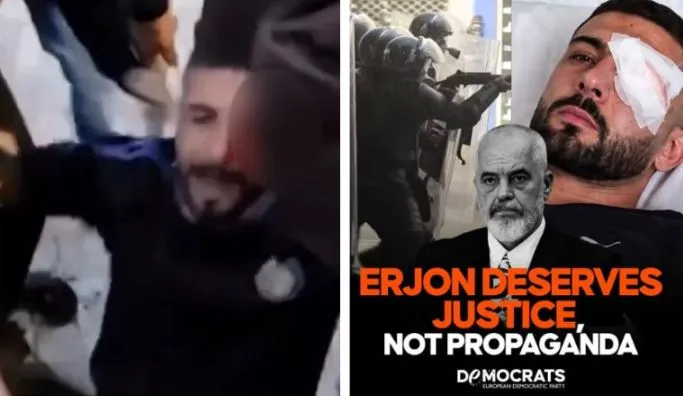 Demokratët Europianë shpërthejnë ndaj Ramës: Erjon Vishkulli ka nevojë për drejtësi, jo propagandë