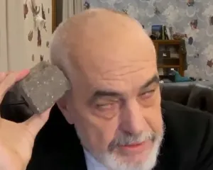 “Duart e huaja” Rama i sulmon të gjithë me një gur