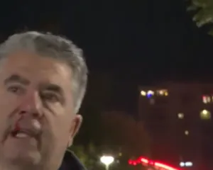 Policia dhunon me shkopinj gome reporterin medias së huaj