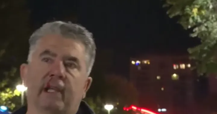 Policia dhunon me shkopinj gome reporterin medias së huaj