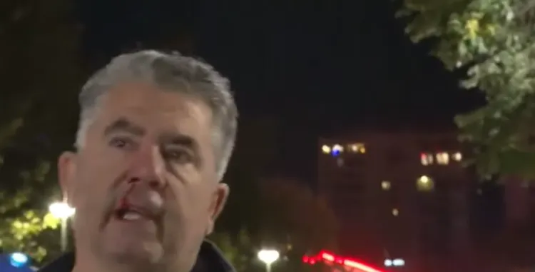Policia dhunon me shkopinj gome reporterin medias së huaj