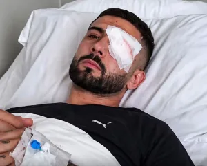 Rrëfehet Erjon Vishkulli: Isha 30 metra larg policëve kur më goditi plumbi në sy”