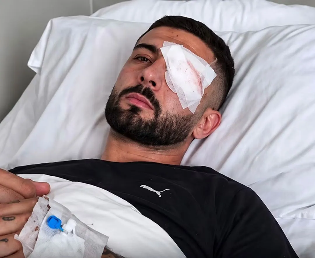 Rrëfehet Erjon Vishkulli: Isha 30 metra larg policëve kur më goditi plumbi në sy”