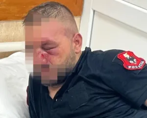 Shëndetësia dhe Policia bëjnë bilancin e revoltës studentore