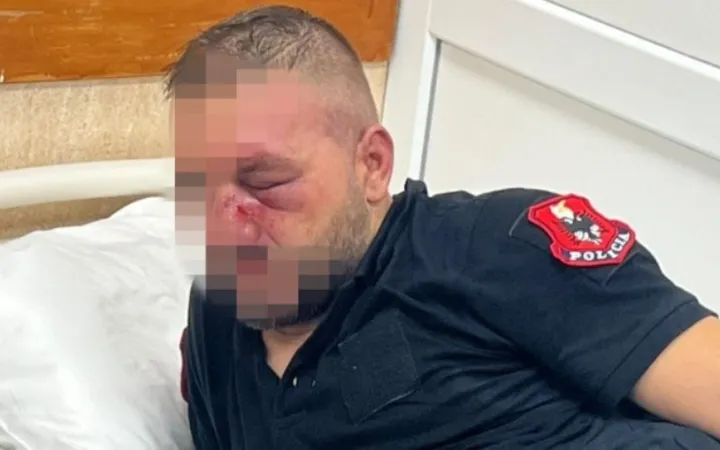 Shëndetësia dhe Policia bëjnë bilancin e revoltës studentore