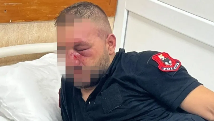 Shëndetësia dhe Policia bëjnë bilancin e revoltës studentore