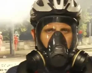 Policia qëllon me plumb gome gazetarin gjatë protestës