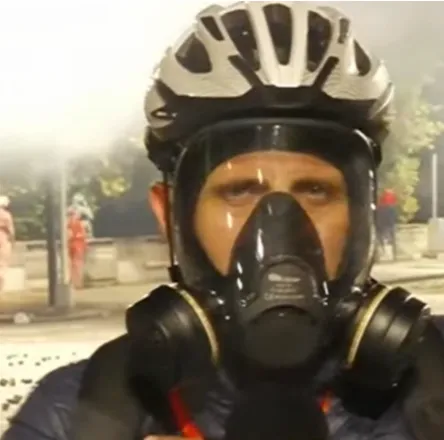 Policia qëllon me plumb gome gazetarin gjatë protestës
