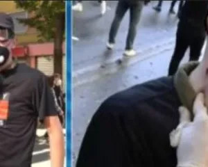 “Isha gati për vdekje”, 17-vjeçari rrëfen tmerrin pasi u godit me plumb gome
