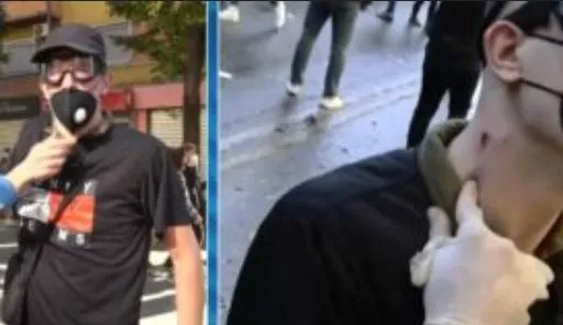 “Isha gati për vdekje”, 17-vjeçari rrëfen tmerrin pasi u godit me plumb gome